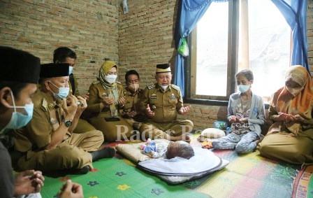 Bupati Lamtim M Dawam Rahardjo saat melihat kondisi bayi delapan bulan, Ahmad Jaelani Bin Ateng Suherman warga Desa Caturswako Kecamatan Bumiagung (IST)