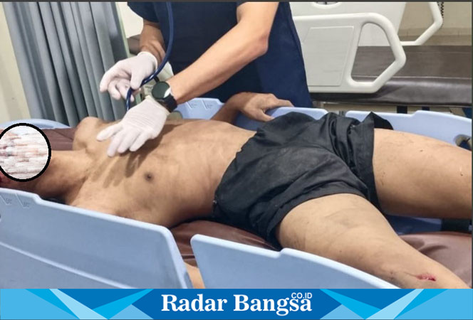 Pemuda Babak belur amukan warga, berbaring sedang mendapat kan perawatan. (Radar Bangsa.co.id/rob).