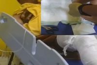 Dua anak di Sampang dirawat akibat luka bakar setelah bermain meriam spirtus, Senin (16/2/2026). (Foto Dok Ho/RadarBangsa.co.id)