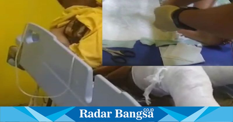 Dua anak di Sampang dirawat akibat luka bakar setelah bermain meriam spirtus, Senin (16/2/2026). (Foto Dok Ho/RadarBangsa.co.id)